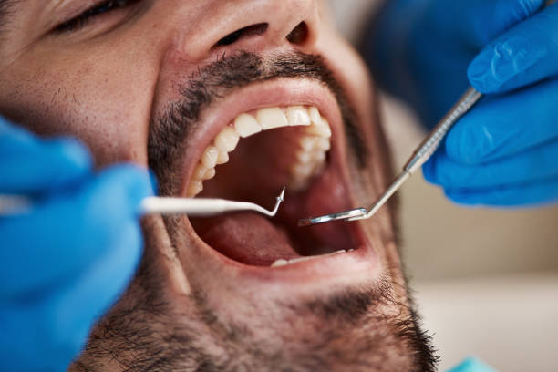 Emergency Dental Services in Wilkes Barre, PA